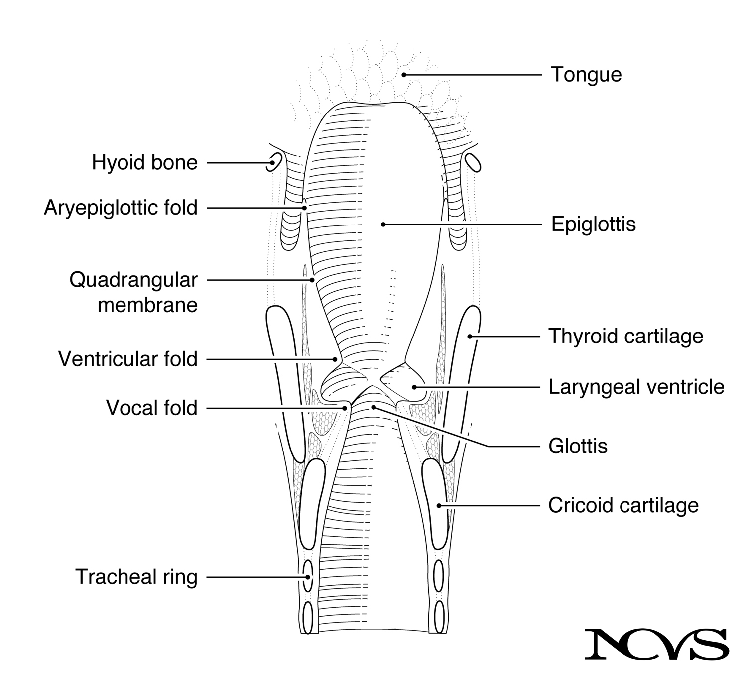 Coronal section through the larynx