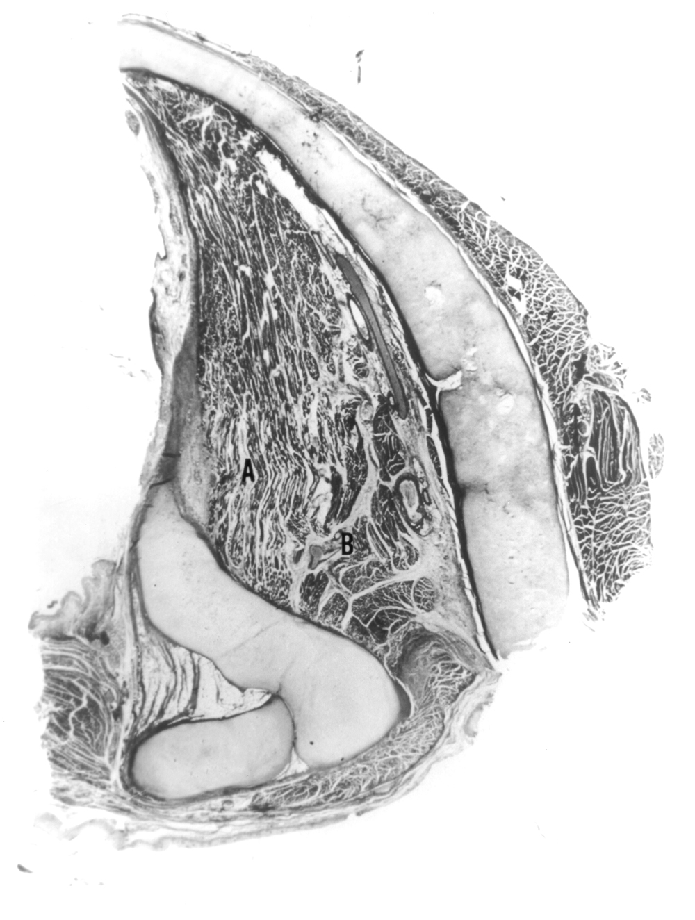 Histological section of the vocal fold