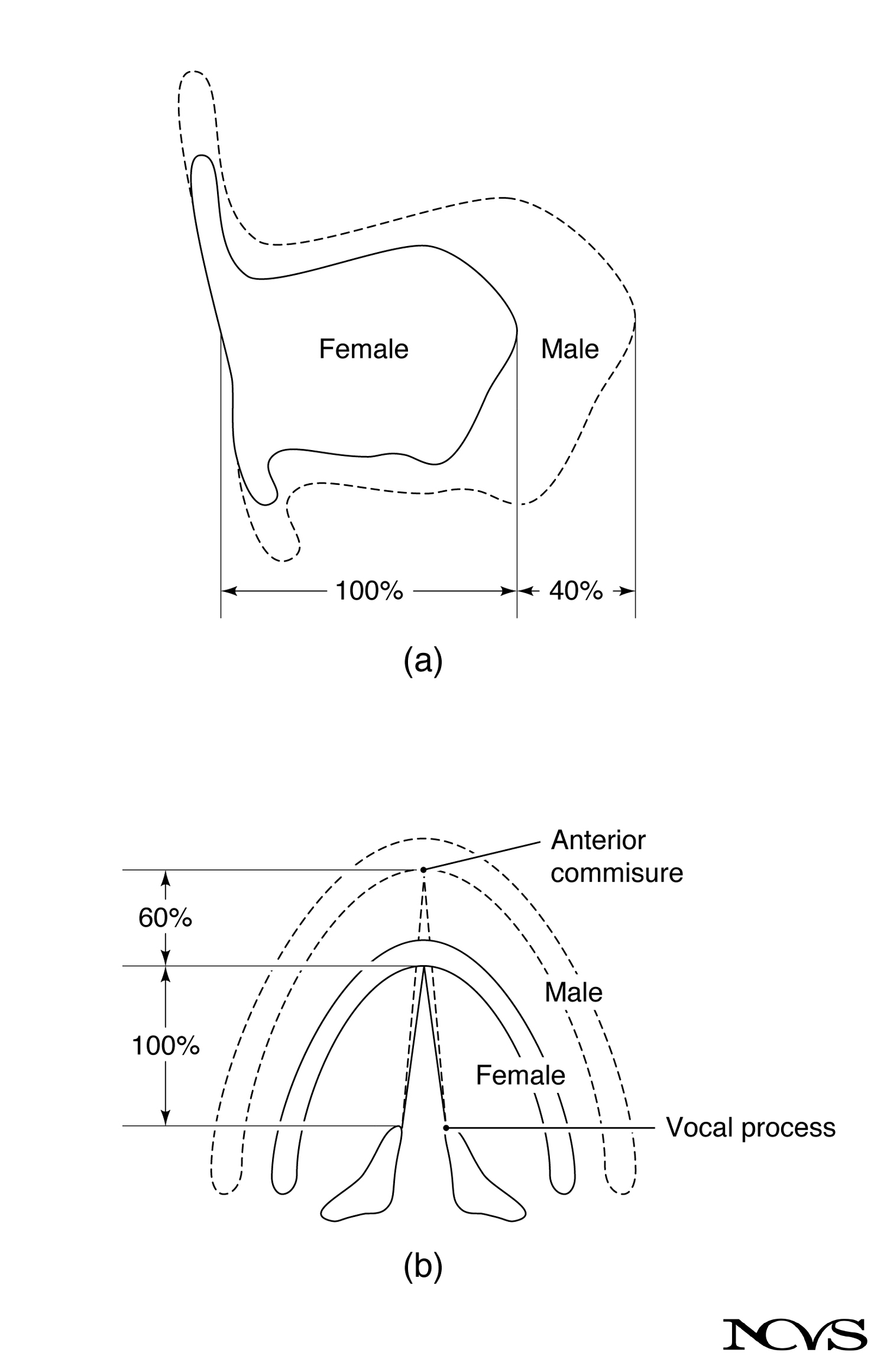 Comparison of laryngeal dimensions for male versus female larynx