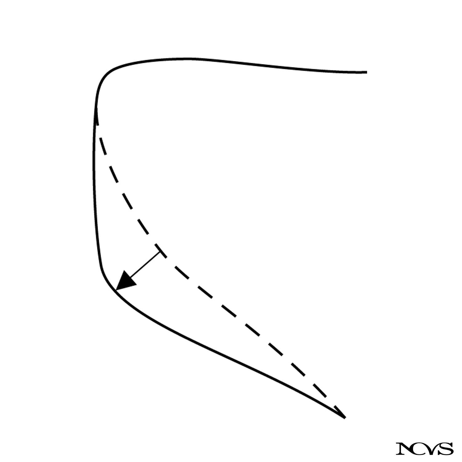 Pubertal vocal fold development