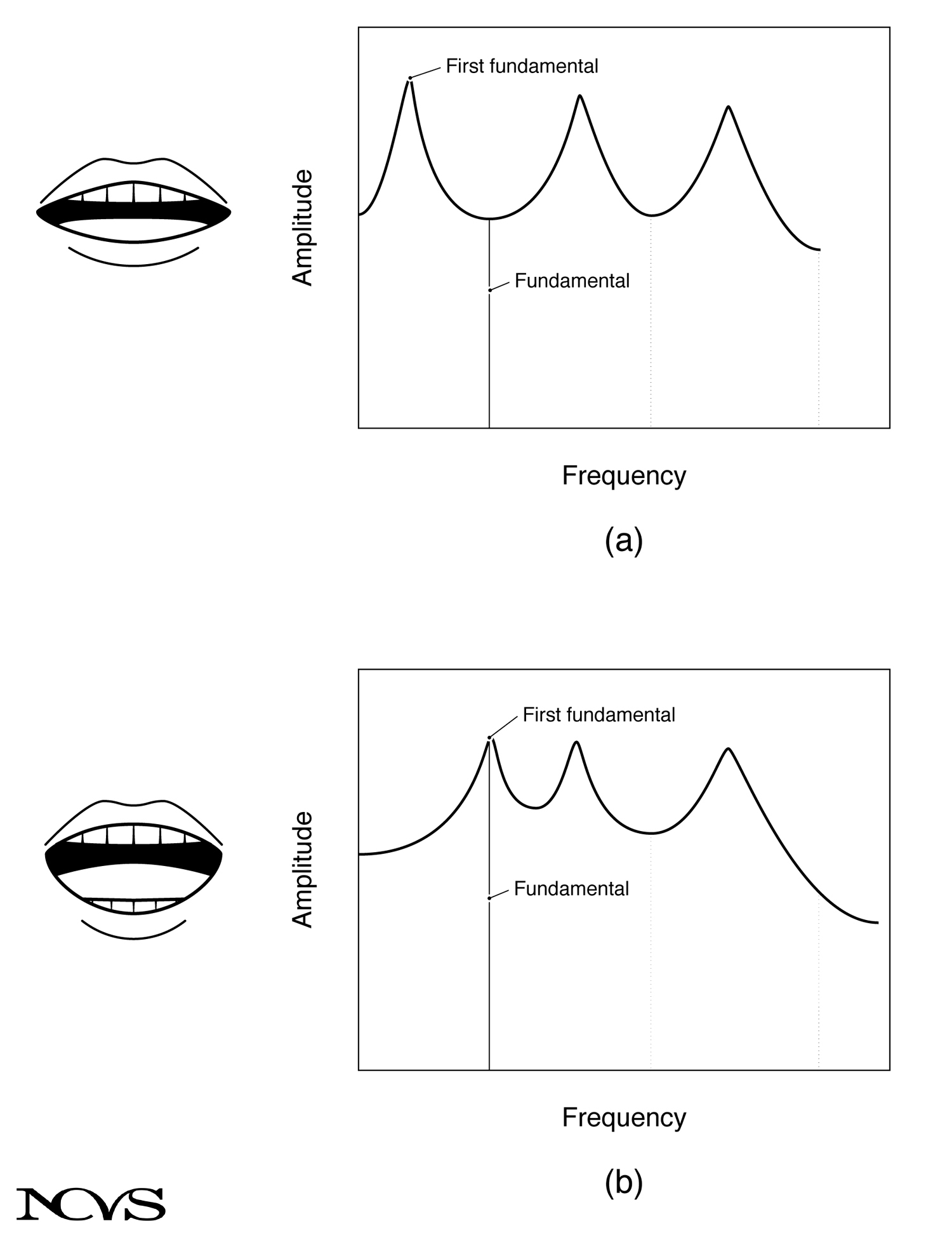 Vocal tract transfer function