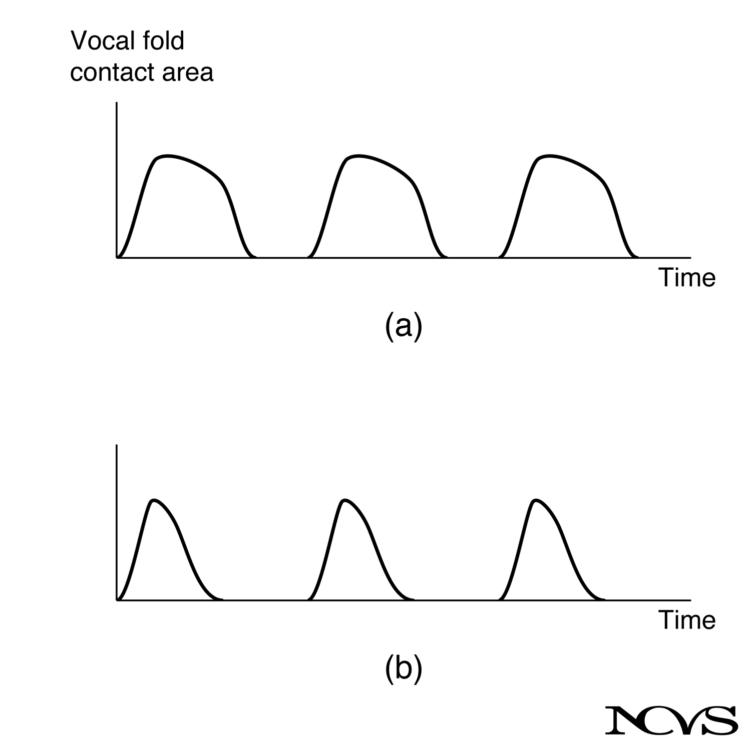 Electroglottograph in use