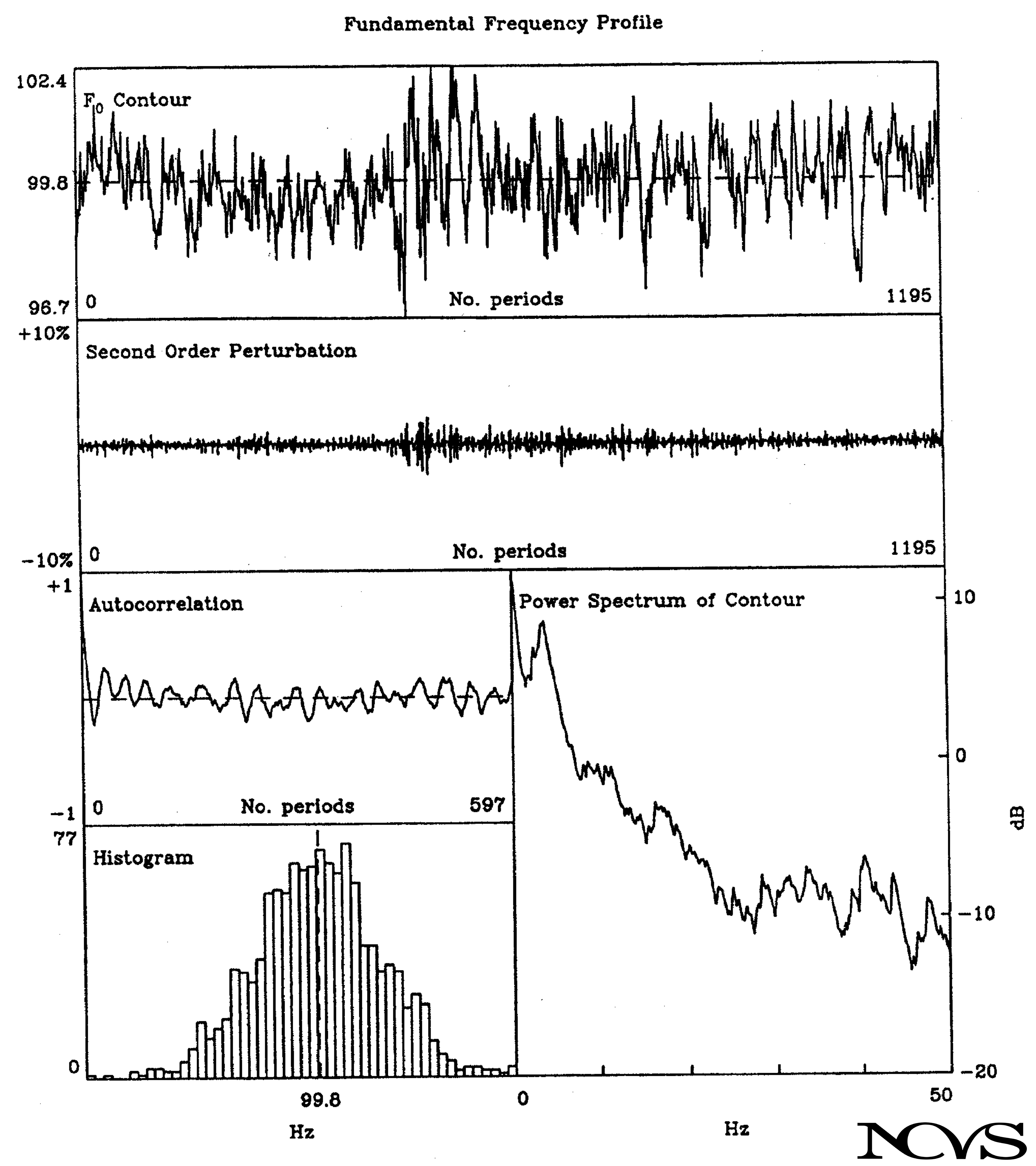 Bifurcations in voice production